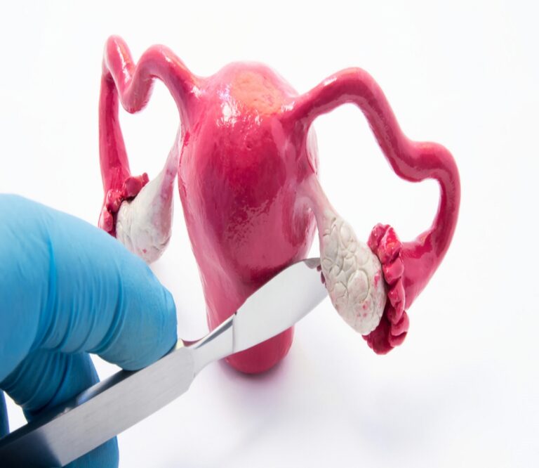 Uterus